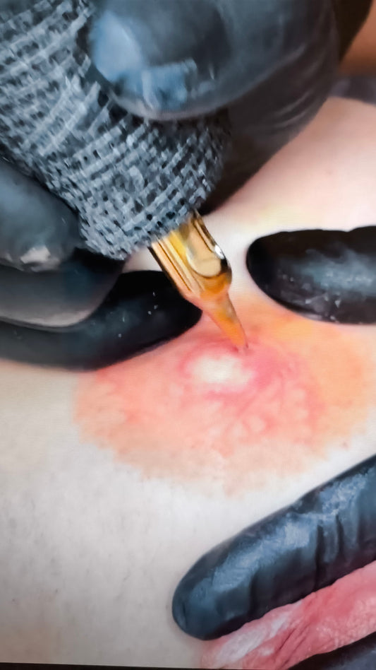 LISTA DE ESPERA - PÓS MASTECTOMIA CANCRO DA MAMA